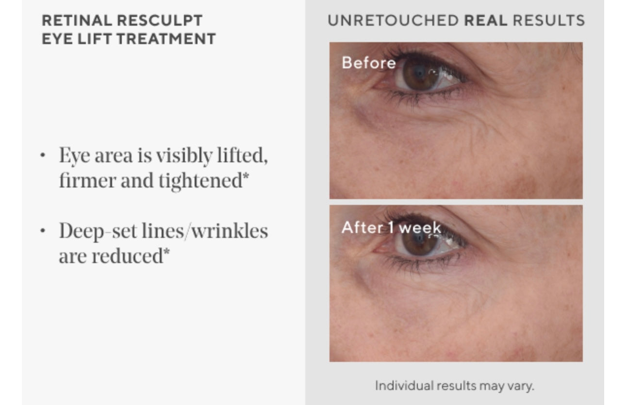 Murad Retinal ReSculpt - Tratamiento de estiramiento de ojos – Crema de ojos antiedad con retina encapsulada, raíz de genciana y película reafirmante de avena para ojos juveniles, aprieta las tapas